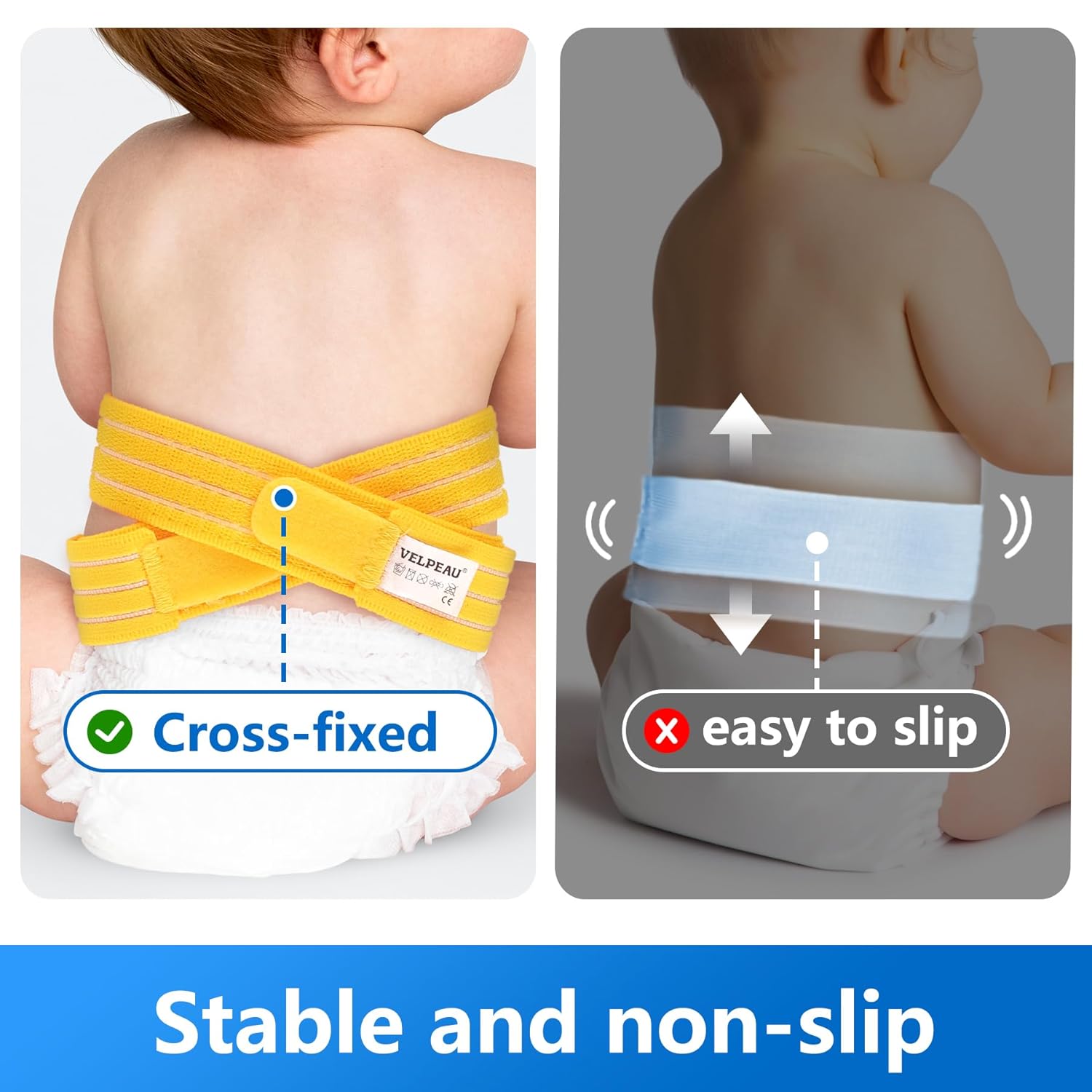 Umbilical Hernia Belt for Infant and Toddler